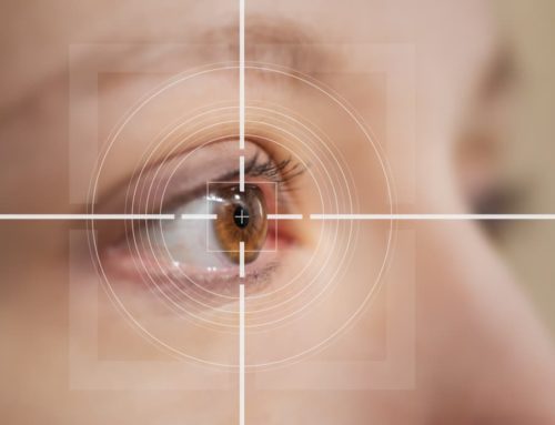 Learn the Difference Between Intraocular Lenses vs. LASIK