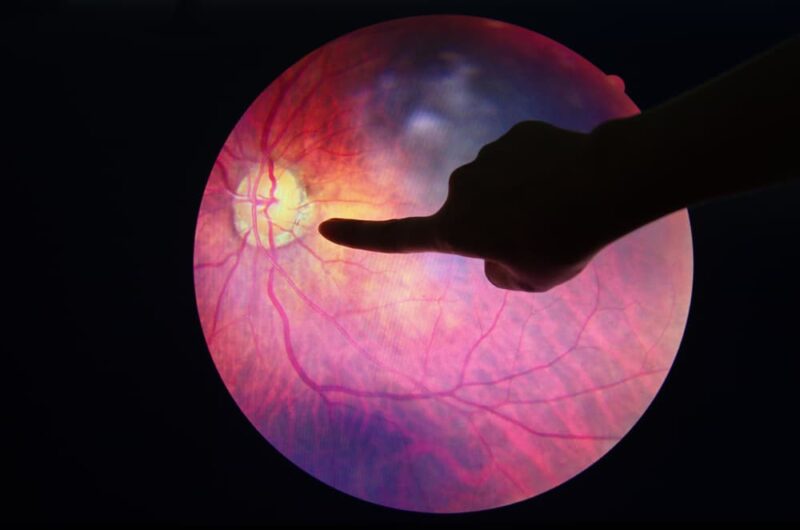 What Are The Causes of Retinopathy? Reno Eye Care Professionals Learn