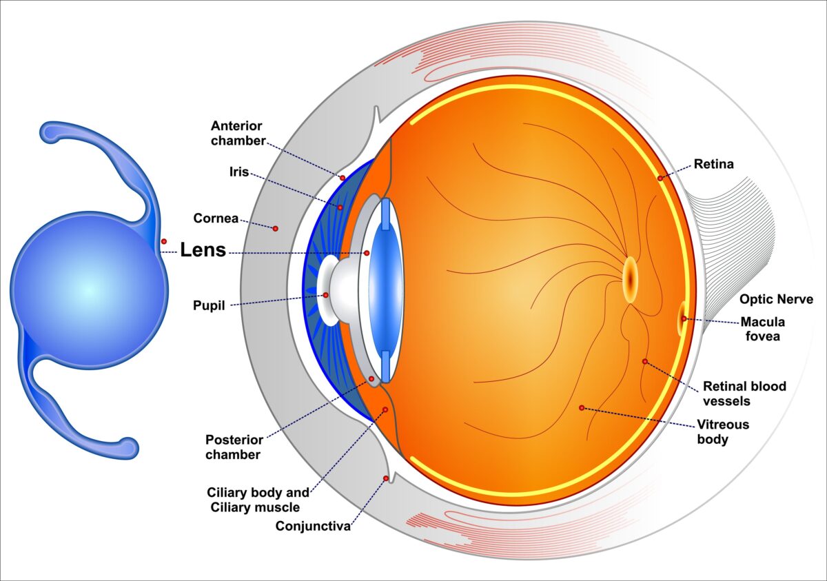 light-adjustable-lenses-vs-traditional-intraocular-lenses