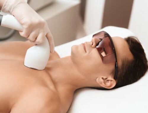 Important Facts About Laser Hair Removal