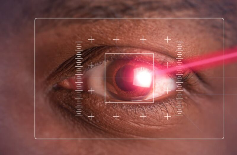 is-lasik-eye-surgery-safe-eye-care-professionals