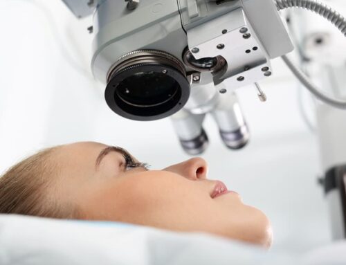 Can You Have RLE After LASIK?