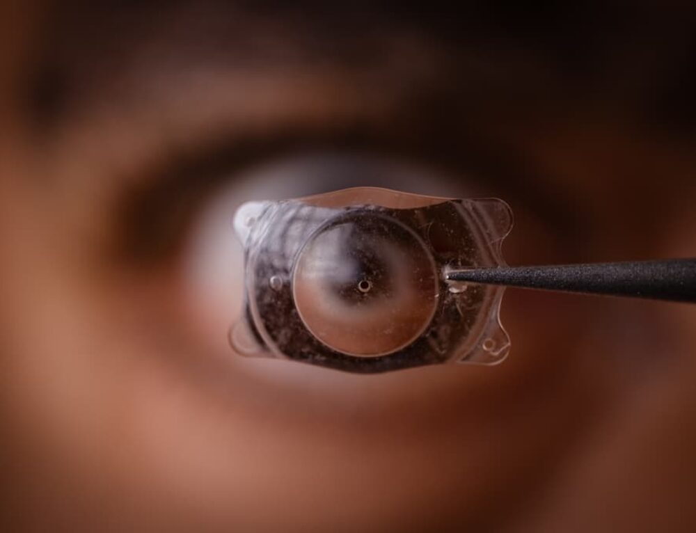 Does laser eye surgery (LASIK) hurt? Reno Eye Care Professionals