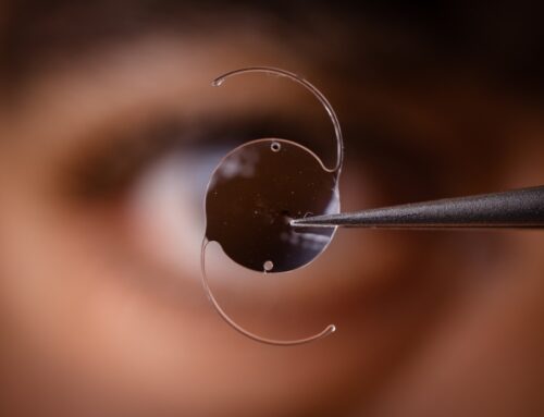 Basics of IOL: What are Intraocular Lens?