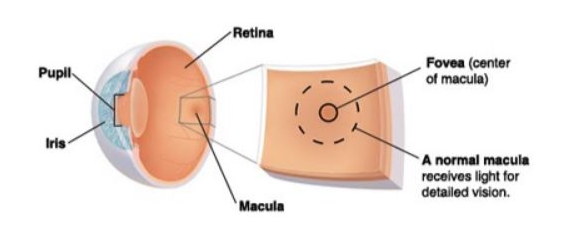 macular-degeneration