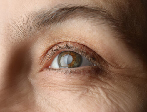 Glaucoma Diagnosis?: Positive Outcomes for Phase 3 Trials of iDose TR