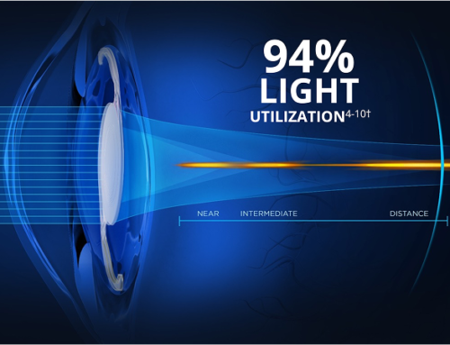 PanOptix Pro: A Better Advanced Intraocular Lens for Cataract Surgery