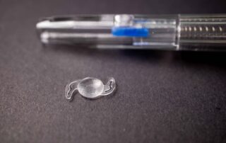 refractive lens exchange