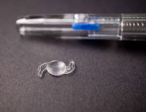 Refractive Lens Exchange Explained: How It Works and Who It’s Best For