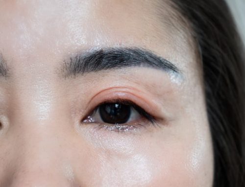 Conjunctivitis vs. Blepharitis: 5 Things You Have to Know