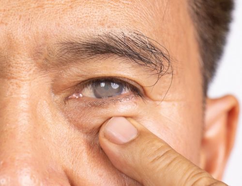 Types of Lenses for Cataract Surgery: 7 Things You Should Know